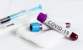 232.200 nouveaux cas de Covid-19 en France en 24 heures