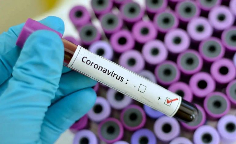 12 nouveaux cas de contamination au Covid-19 au Sénégal soit 219 depuis le début de l’épidémie
