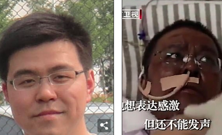 Atteints du coronavirus, la peau de deux médecins chinois vire au… noire