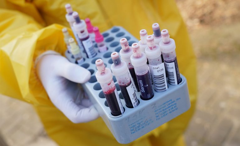 Le Sénégal se rapproche de la barre fatidique des 1000 cas de contamination au coronavirus avec 933 personnes infectées