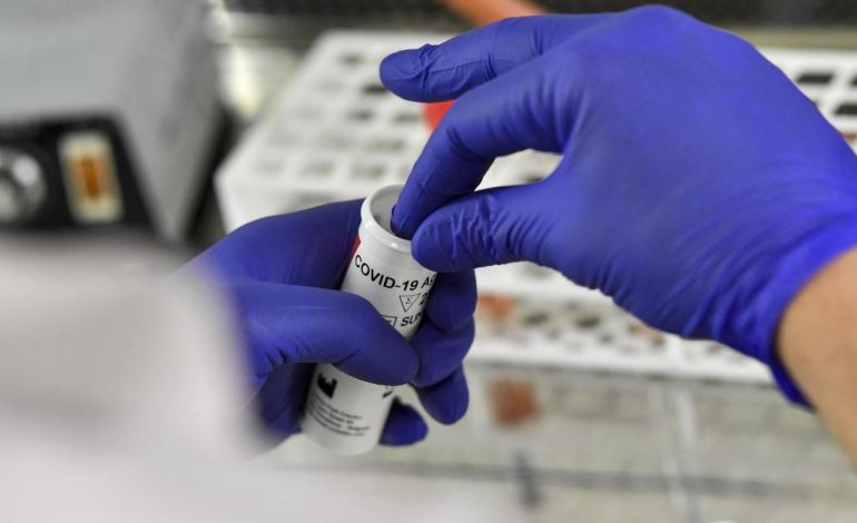 97 nouvelles contaminations, 9 cas graves pour 2714 cas de coronavirus au Sénégal ce 20 mai