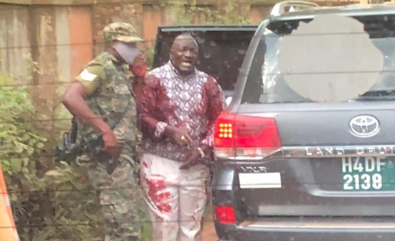 Le Ministre Ougandais des Transports blessé par balles, sa fille et son garde du corps tués lors d’une attaque