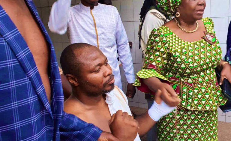 Guy Marius Sagna blessé lors d’une rencontre politique de l’opposition à Lomé